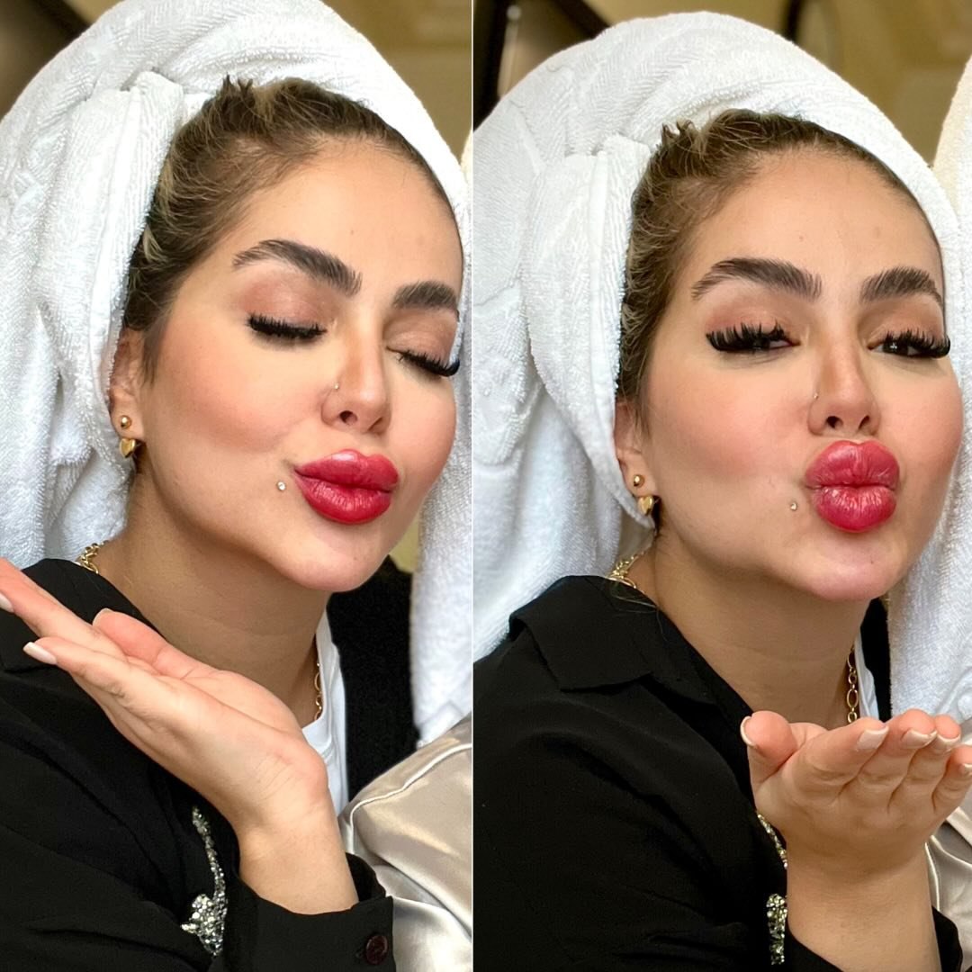 صبالاین
